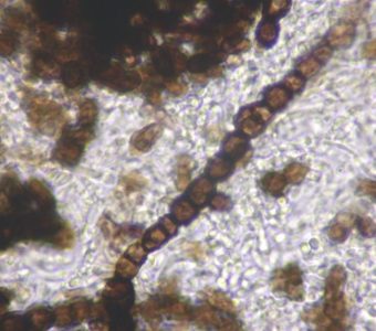 黒色酵母様菌（アウレオバシジウム（Aureobasidium）属）の拡大写真